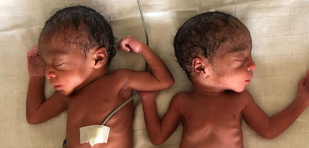 Tvillingar som föddes i i staden Mamfe i sydvästra Kamerun.