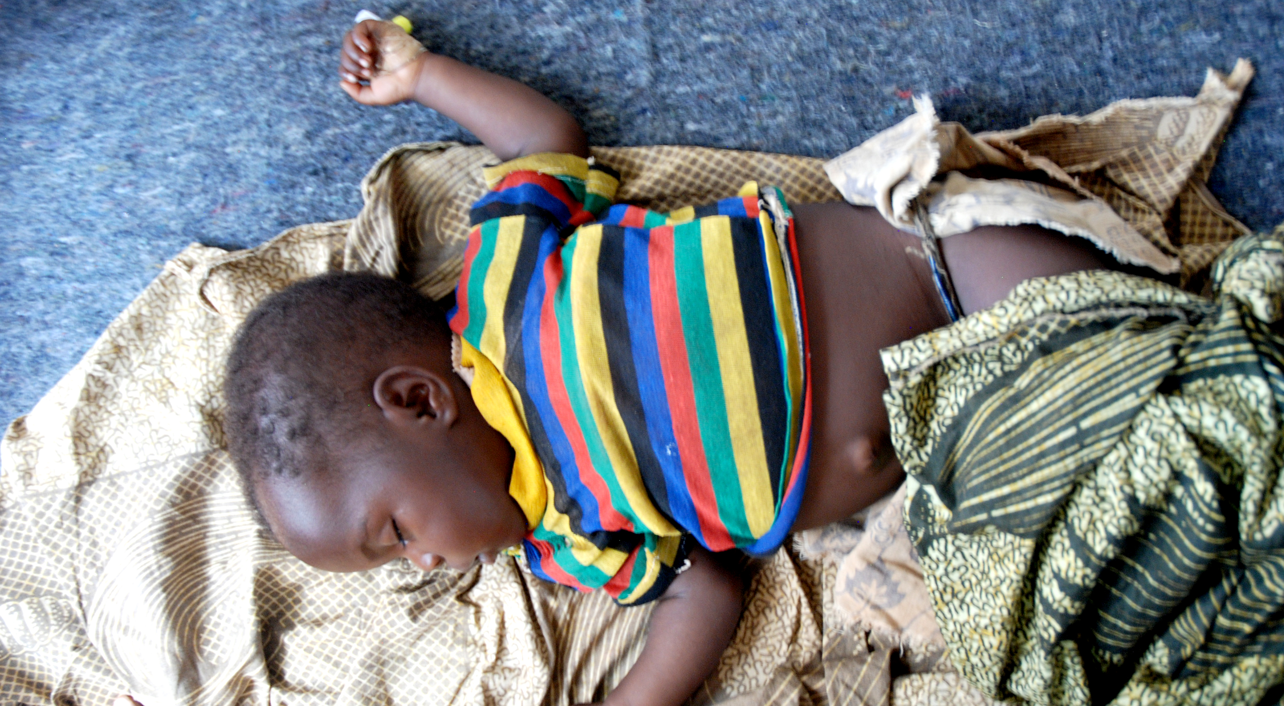 Malaria är dödligt för små barn som behöver vård av hög kvalitet. 