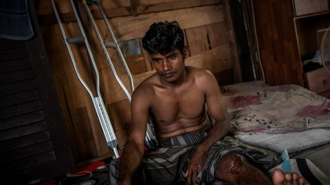 En ung rohingyaflykting i Malysia som skadat sitt ben i arbetet