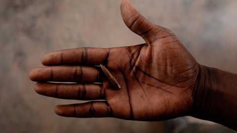 En hand visar upp kulan som träffade France Beldo i Centralafrikanska republiken.