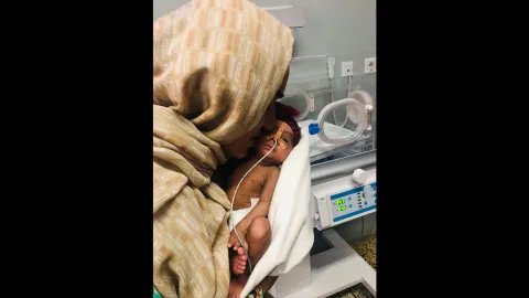 en förtidigt född bebis med syrgasslang i näsan hålls av sin mamma på neonatalintensiven 
