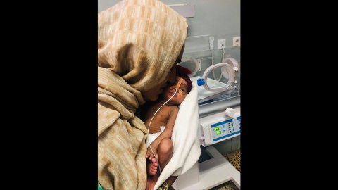 en förtidigt född bebis med syrgasslang i näsan hålls av sin mamma på neonatalintensiven 