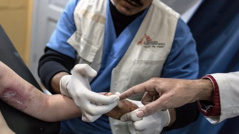 En brännskadad patient får såren omlagda på Läkare Utan Gränsers postoperativa klinik i Gaza. På grund av de täta bombningarna är det svårt för patienter och hjälparbetare att förflytta sig i Gaza. FOTO: Chris Huby