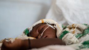 Ett barn får syrgas i N’Djamena, Tchad