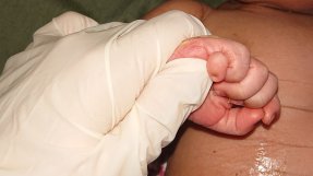 En hand i en sjukhushandske håller i ett litet barns hand