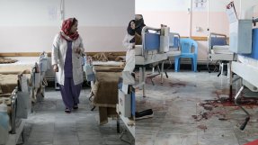 En före och efterbild på avdelningar på sjukhuset med blod på golvet på den andra bilden