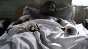 Paul som vårdas på Saint Mary Soledad-sjukhuset i Bamenda, Kamerun.