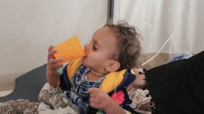 Tvååriga Nouf Ibrahim vårdades för misstänkt kolera i vårt kolerabehandlingsenheten i Ibb, Jemen. 