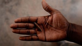 En hand visar upp kulan som träffade France Beldo i Centralafrikanska republiken.