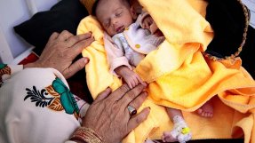 En liten bebis, som är inskriven på Läkare Utan Gränsers undernäringsklinik i Herat, Afghanistan, ligger på en gul filt. En kvinnas händer syns bredvid filten.