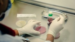 Bild på person med gummihandskar som håller i en pimpett i ett laboratorium i Aden, Jemen, där vi testar vilken typ av antibiotika som behövs.