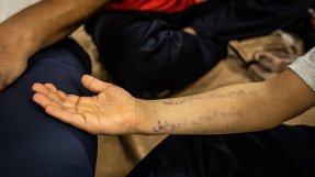 Den sjuårige pojken Ali visar sin arm där hans pappa har skrivit kontaktuppgifterna till hans mamma i Syrien.