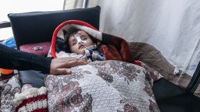 En liten flicka som lider av kolera får vård av Läkare Utan Gränser i Jemen