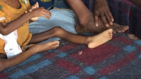 <p>En liten patient får vård på sjukhuset i Bolomba, Kongo-Kinshasa, där Ludvig Bolinder arbetar.</p>
En liten patient får vård på sjukhuset i Bolomba, Kongo-Kinshasa, där Ludvig Bolinder arbetar.