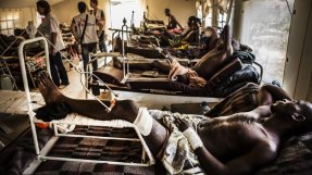 Många av patienterna på Community-sjukhuset i Bangui har skottskador i benen.