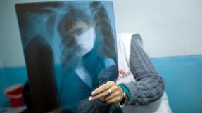Vår läkare Natalia visar en röntgenbild för en patient med extremt multiresistent tbc på sjukhuset Kara Suu, Kirgizistan.