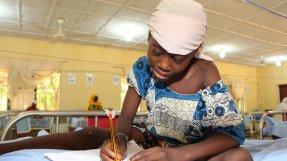 Flicka med sjukdomen noma efter operation i Sokoto, Nigeria.