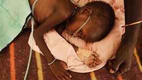 Tre år gamla Nyataba behandlas för både lunginflammation och undernäring på vårt sjukhus i skyddslägret Bentiu, Sydsudan.