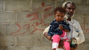 Saleh Mohammed och hans två år gamla dotter som bor utanför Abs, Jemen.