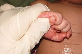 En hand i en läkarhandske som håller i ett litet barns hand