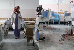 En före och efterbild på avdelningar på sjukhuset med blod på golvet på den andra bilden