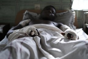 Paul som vårdas på Saint Mary Soledad-sjukhuset i Bamenda, Kamerun.