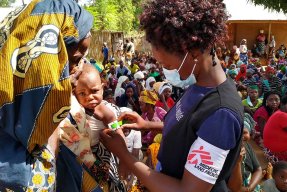 En kvinna från Läkare Utan Gränser mäter överarmen på ett litet barn med måttbandet MUAC i Meluco , provinsen Cabo Delgado i Moçambique.
