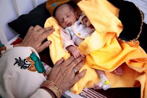 En liten bebis, som är inskriven på Läkare Utan Gränsers undernäringsklinik i Herat, Afghanistan, ligger på en gul filt. En kvinnas händer syns bredvid filten.
