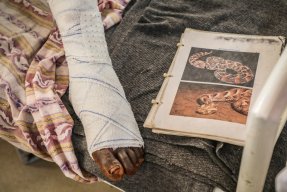 En fot i bandage bredvid ett fotoalbum med bilder på en orm.