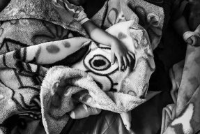 Syskonen, som skadades i explosionen i Irak. 