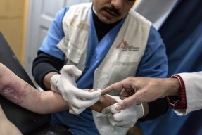 En brännskadad patient får såren omlagda på Läkare Utan Gränsers postoperativa klinik i Gaza. På grund av de täta bombningarna är det svårt för patienter och hjälparbetare att förflytta sig i Gaza. FOTO: Chris Huby