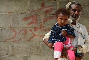 Saleh Mohammed och hans två år gamla dotter som bor utanför Abs, Jemen.