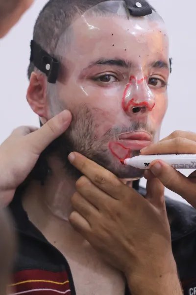En man har en plastmask för ansiktet. En annan personer målar på masken med en röd penna.