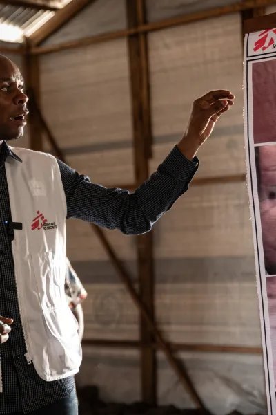 Man med Läkare Utan Gränser väst pekar mot en plansh som visar symptom av mpox