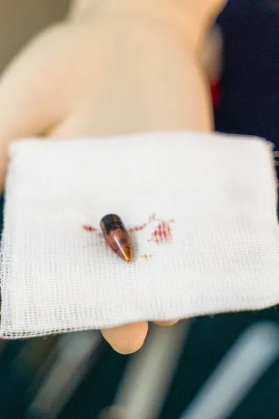Kula från ett handeldvapen på en gasbinda med spår av blod, framhållen av en hanskbeklädd hand