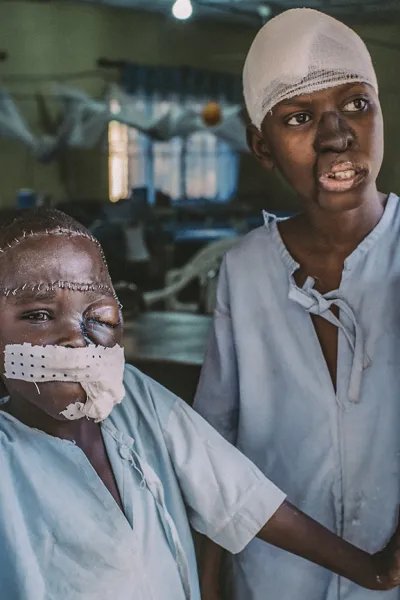 Åttaåriga Umar och femtonåriga Adamu står vid ingången till den postoperativa avdelningen på Sokoto sjukhus.