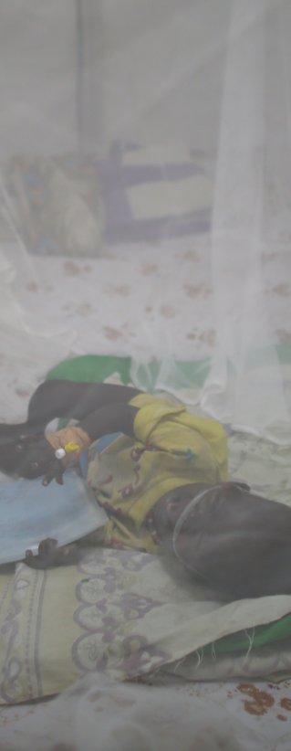 Ett barn ligger under ett myggnät på en säng i Sydsudan.