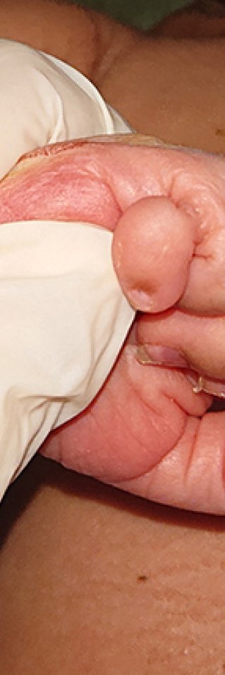 En hand i en läkarhandske som håller i ett litet barns hand