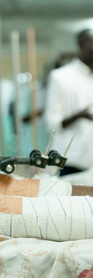 Ett gipsat ben på en sjukhussäng.