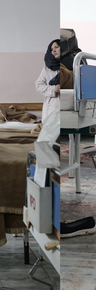 En före och efterbild på avdelningar på sjukhuset med blod på golvet på den andra bilden