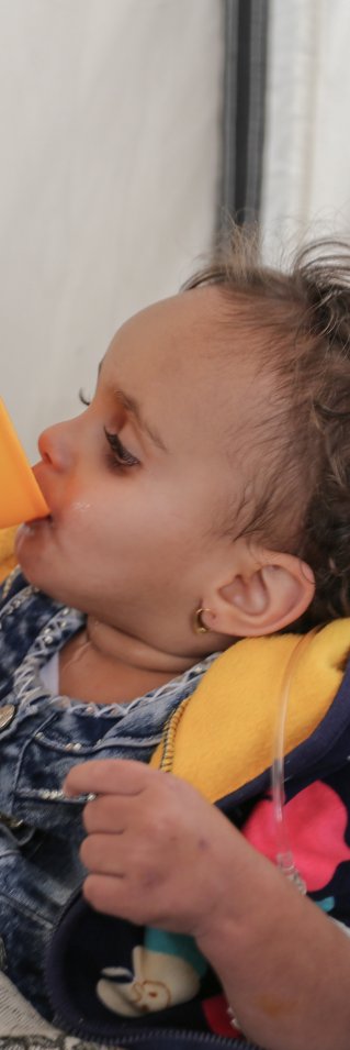 Tvååriga Nouf Ibrahim vårdades för misstänkt kolera i vårt kolerabehandlingsenheten i Ibb, Jemen. 