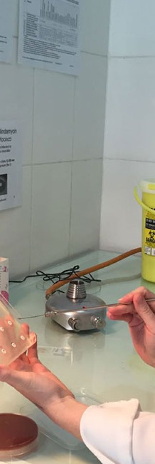 På Läkare Utan Gränsers sjukhus i Aden i Jemen finns ett laboratorium där bakterier analyseras för att avgöra vilken typ av antibiotika som är mest effektiv.