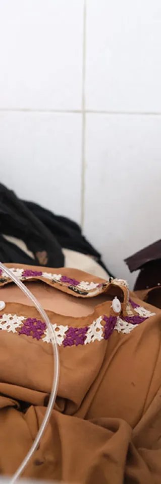En pojke som har mässling får syrgas och ligger på en säng på Boost sjukhus, Afghanistan.