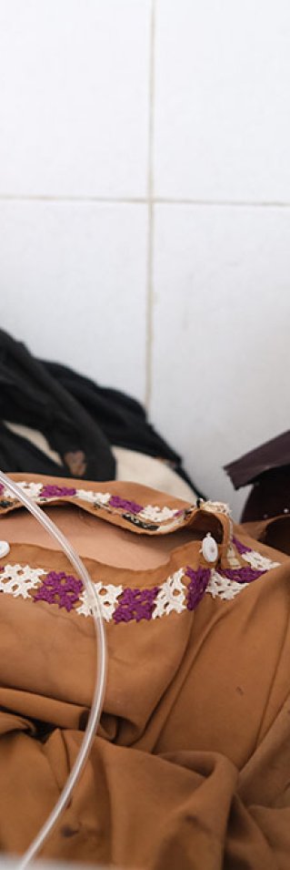 En pojke som har mässling får syrgas och ligger på en säng på Boost sjukhus, Afghanistan.