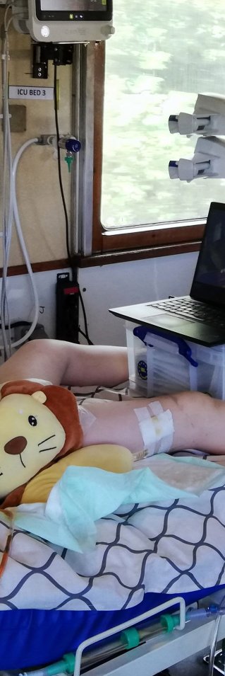 En skadad pojke ligger i en sjukhussäng på Läkare Utan Gränsers medicinska tåg i Ukraina
