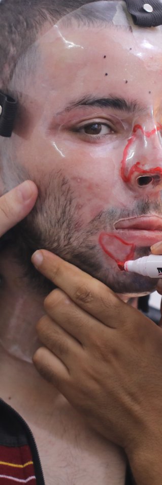 En man har en plastmask för ansiktet. En annan personer målar på masken med en röd penna.