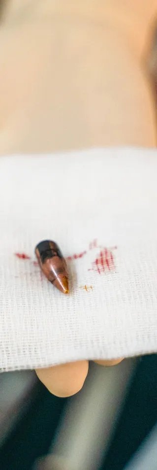 Kula från ett handeldvapen på en gasbinda med spår av blod, framhållen av en hanskbeklädd hand