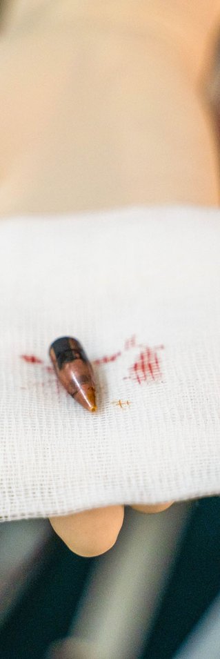 Kula från ett handeldvapen på en gasbinda med spår av blod, framhållen av en hanskbeklädd hand