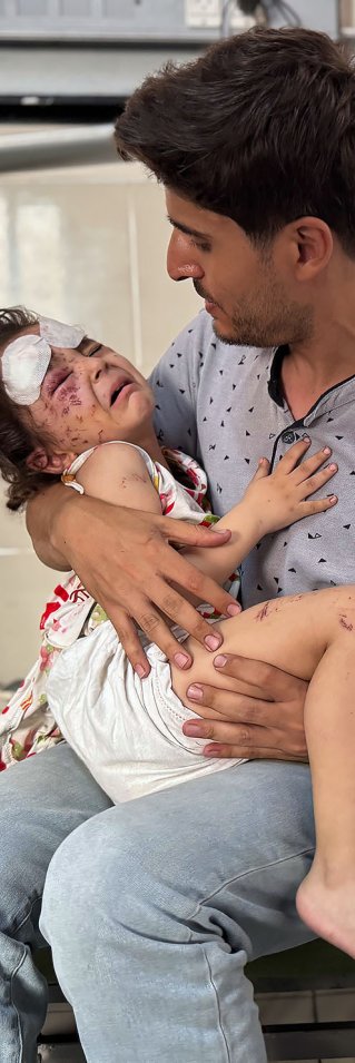 Man med sitt skadade barn i famnen på ett sjukhus i Gaza