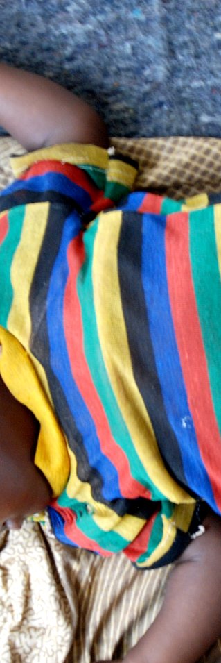 Malaria är dödligt för små barn som behöver vård av hög kvalitet. 